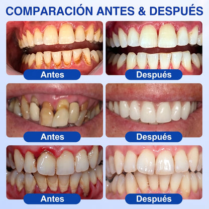 𝐇𝐈𝐒𝐊𝐈𝐍®👩‍⚕️🇪🇸🏅🦷🛡️ HISKIN® GumRevive Gel Reparador Periodontal