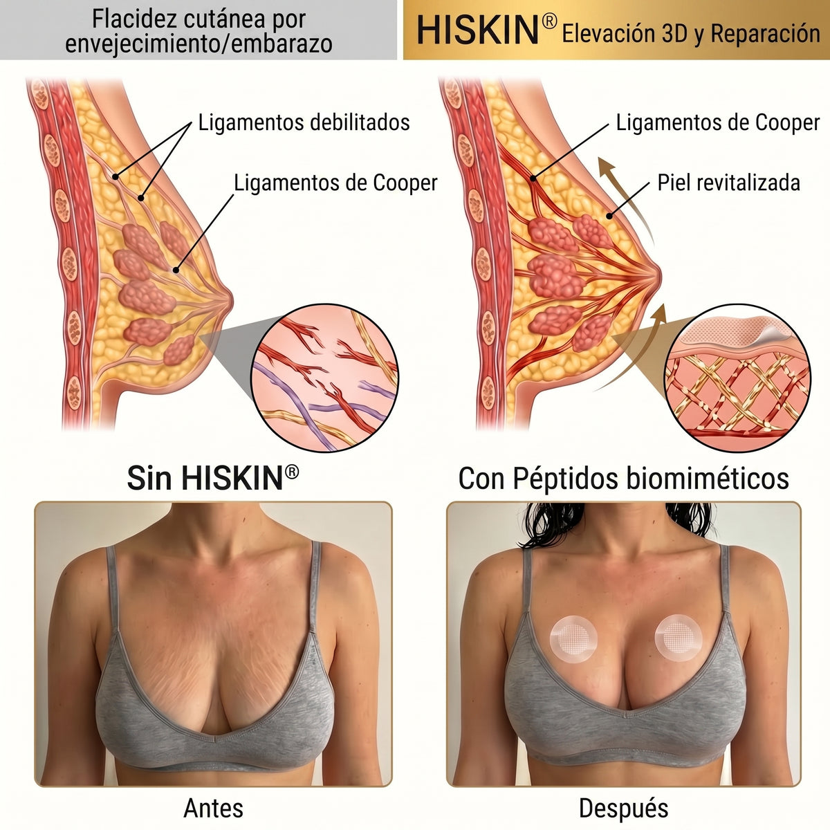 👩‍⚕️ Firmeza & Galbo del Pecho HISKIN® — Parche Nano-Microneedle Avanzado de Acción Dirigida