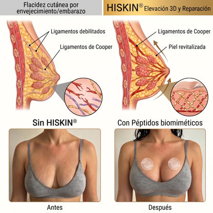 👩‍⚕️ Firmeza & Galbo del Pecho HISKIN® — Parche Nano-Microneedle Avanzado de Acción Dirigida