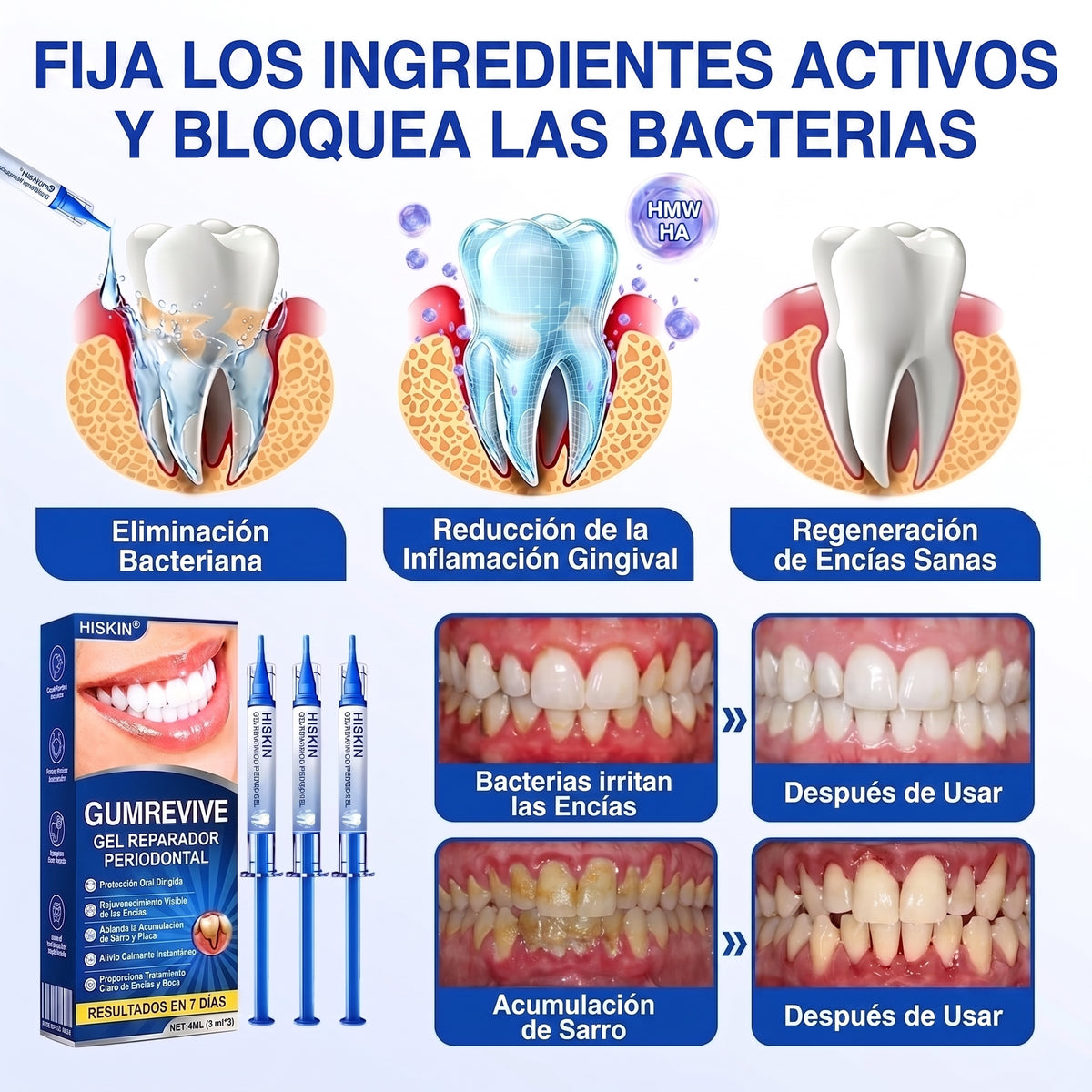 𝐇𝐈𝐒𝐊𝐈𝐍®👩‍⚕️🇪🇸🏅🦷🛡️ HISKIN® GumRevive Gel Reparador Periodontal