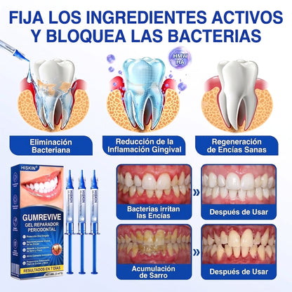 𝐇𝐈𝐒𝐊𝐈𝐍®👩‍⚕️🇪🇸🏅🦷🛡️ HISKIN® GumRevive Gel Reparador Periodontal